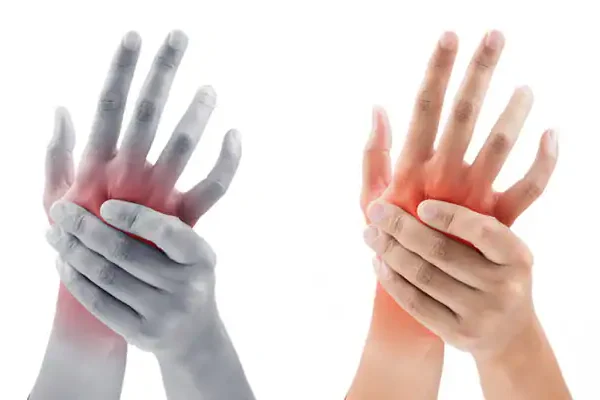 5 Tips Menjaga Tangan Tetap Hangat saat Cuaca Dingin 5 Tips Menjaga Tangan Tetap Hangat saat Cuaca Dingin