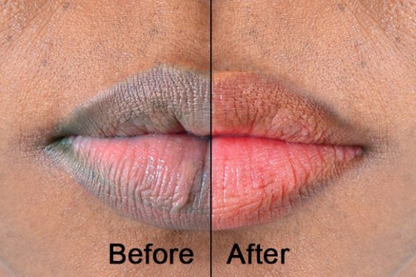 5 Cara Cepat Mengembalikan Warna Alami Bibir