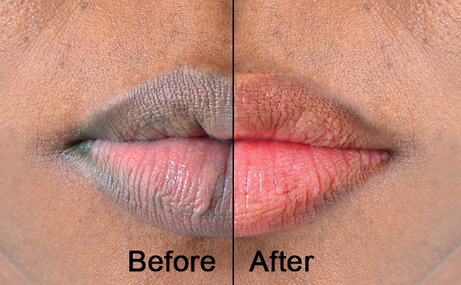 5 Cara Cepat Mengembalikan Warna Alami Bibir