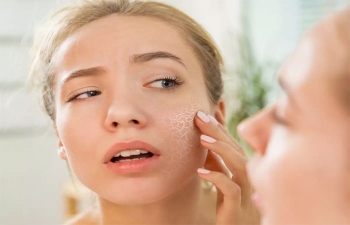 7 Cara Menangani Kulit Kering di Dagu Secara Alami