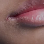 5 Kebiasaan Kecil yang Bisa Merusak Kesehatan Bibir