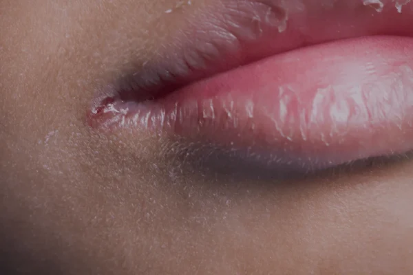 5 Kebiasaan Kecil yang Bisa Merusak Kesehatan Bibir